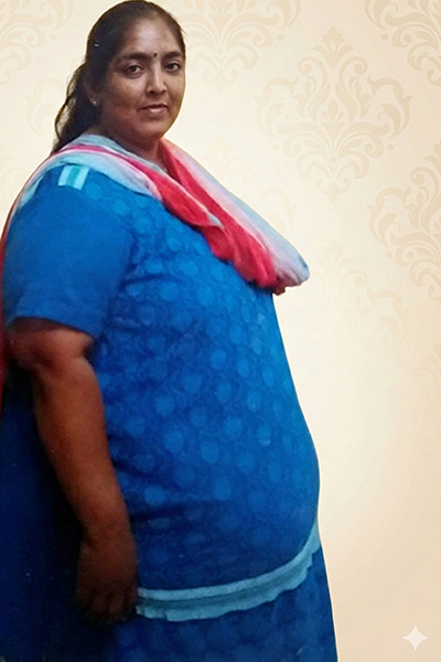 Sangeetha before her wellness journey at 140 kg